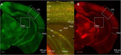 Not All That Is Gold Glitters: PV-IRES-Cre Mouse Line Shows Low Efficiency of Labeling of Parvalbumin Interneurons in the Perirhinal Cortex